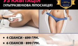 Ультразвукова кавітація (ліпосакція та схуднення) Косметологический центр Стиль Лилий Нежин
