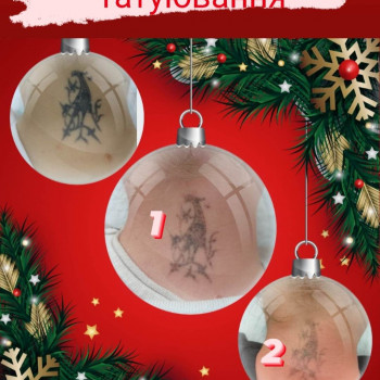 Лазерне видалення тату і татуажу
                    Косметологический центр Стиль Лилий Нежин