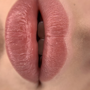 ЗАГОЄНІ губки