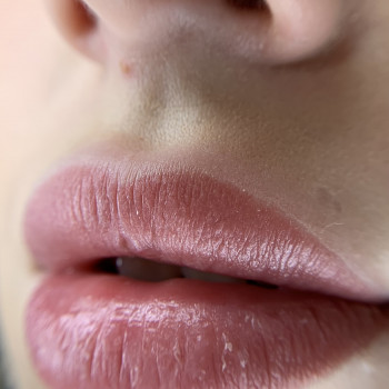 ЗАГОЄНІ губки