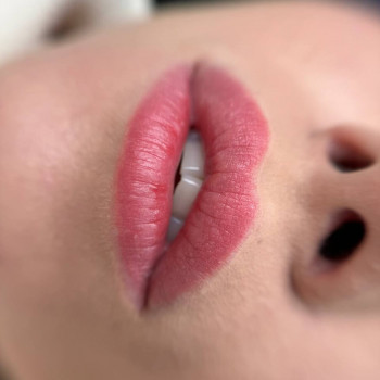 ЗАГОЄНІ губки