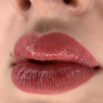 Відразу після процедури