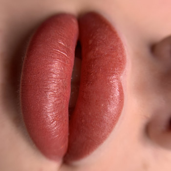 Відразу після процедури