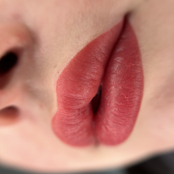 Відразу після процедури