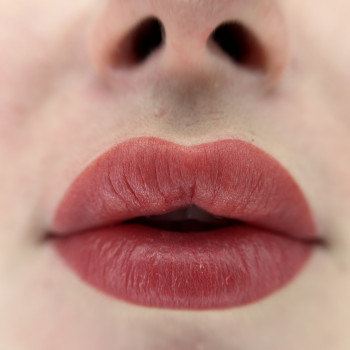 Відразу після процедури