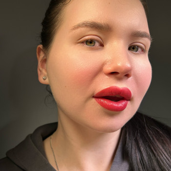 Відразу після процедури