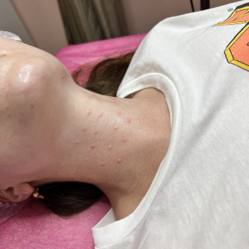 Фото з портфоліо косметолога Даниэла Циммерманн-Чукуренко (Черкаси)