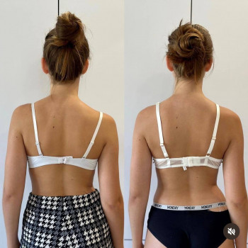 Лікувальний масаж
                    Масажний салон MD PRO Київ