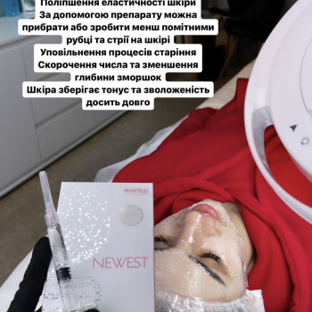 Oksana Kucheriava, Черкаси Фото - 4