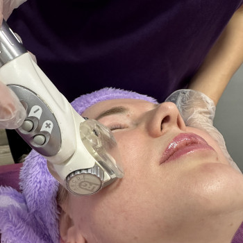 LPG масаж обличчя
                    Косметологічний центр My B-flexy Ірпінь