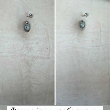 Лілія Свєчнікова, Київ Фото - 17