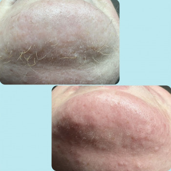 Лілія Свєчнікова, Київ Фото - 21