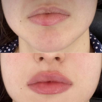 Оксана Делятин, Київ Фото - 24