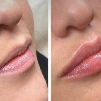 Оксана Делятин, Київ Фото - 39