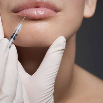 Оксана Делятин, Київ Фото - 41