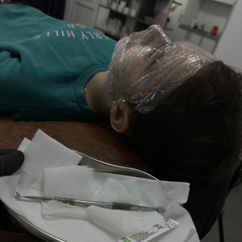 Комбінована чистка обличчя
                    Косметолог-естетист  Кам'янець-Подільський