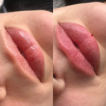 Збільшення губ
                    Майстер перманентного макіяжу Елена Київ