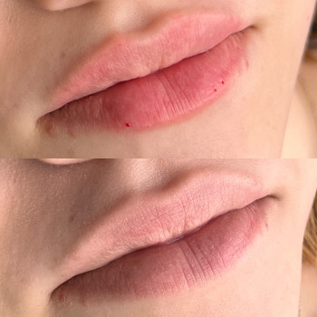 Збільшення губ
                    Майстер перманентного макіяжу Елена Київ