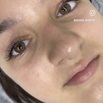 Оксана Глімбоцька, Чернівці Фото - 12