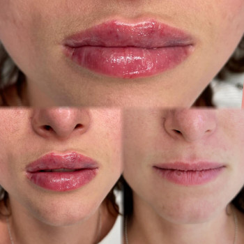 Тетяна Манастирна, Ірпінь Фото - 5