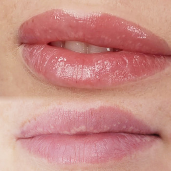 Тетяна Манастирна, Ірпінь Фото - 1