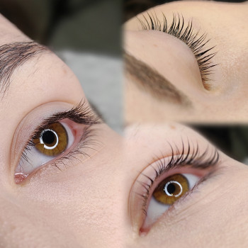 Ламі вій ботокс