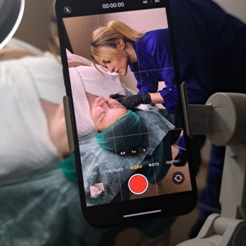 Чистка обличчя