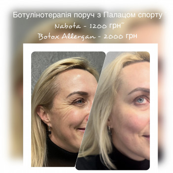 фулфейс