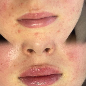 Оксана Гукалюк, Київ Фото - 17