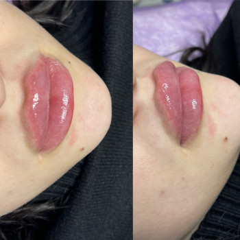 Наталія Книженко, Київ Фото - 11