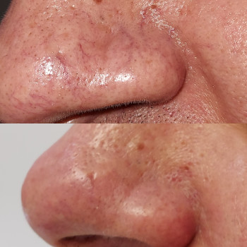 Світлана Толстоног, Одеса Фото - 14