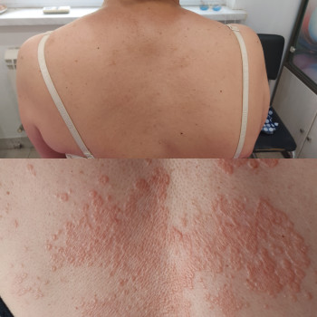 Світлана Толстоног, Одеса Фото - 16