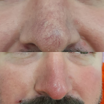 Світлана Толстоног, Одеса Фото - 20