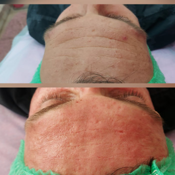 Світлана Толстоног, Одеса Фото - 25