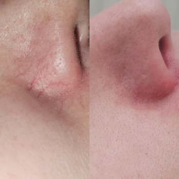 Світлана Толстоног, Одеса Фото - 26