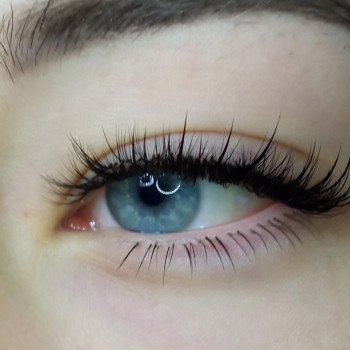 Промінчики та нижнє нарощування