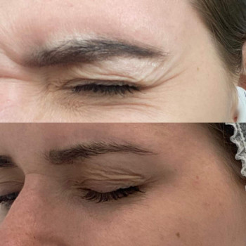 Ліля Щербінська, Івано-Франківськ Фото - 7