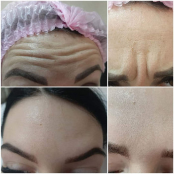 Ліля Щербінська, Івано-Франківськ Фото - 8