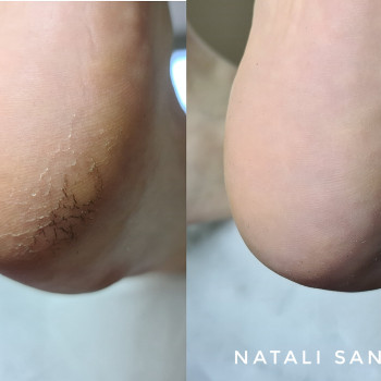 Наталия Санина, Киев Фото - 62