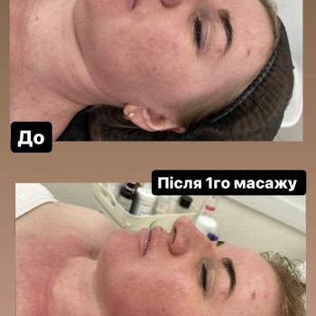Масаж обличчя 60хв
                    Массажист Дарья Киев
