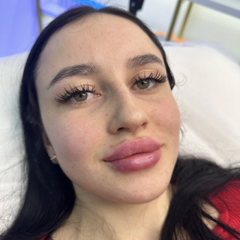 Тетяна Асколіна, Вінниця Фото - 14