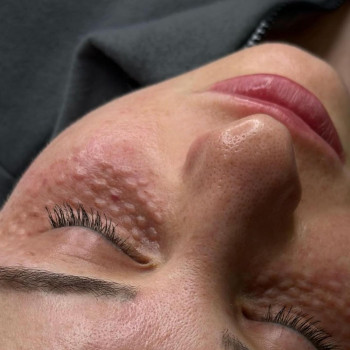 Тетяна Асколіна, Вінниця Фото - 17