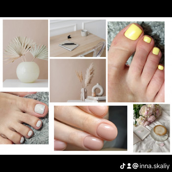 Інна Скалій, Жёлтые Воды Фото - 10