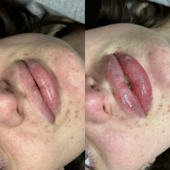 Руслана Мицней, Черновцы Фото - 23