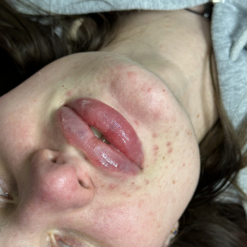 Руслана Мицней, Черновцы Фото - 25