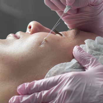 Тредліфтинг, безопераційна підтяжка обличча #тредліфтингсуми #фотографсумы #фотографсуми #весіллясум