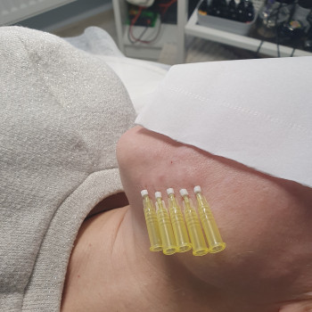 Укріплюємо каркас       