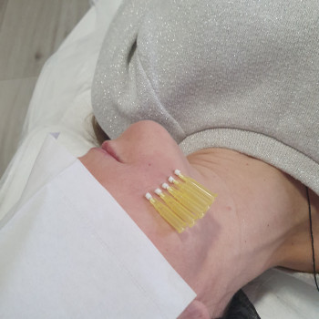 Швидка реабілітація       