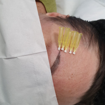 Броуліфтинг       