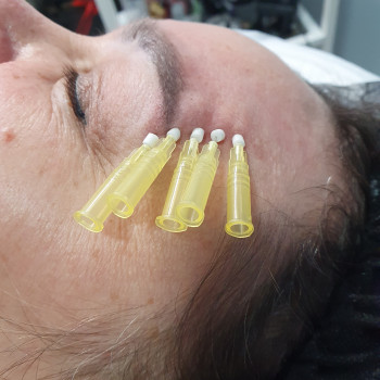 Броуліфтинг       